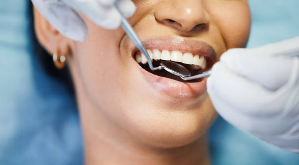 Best Emergency Denture Repair in Delhi, CA